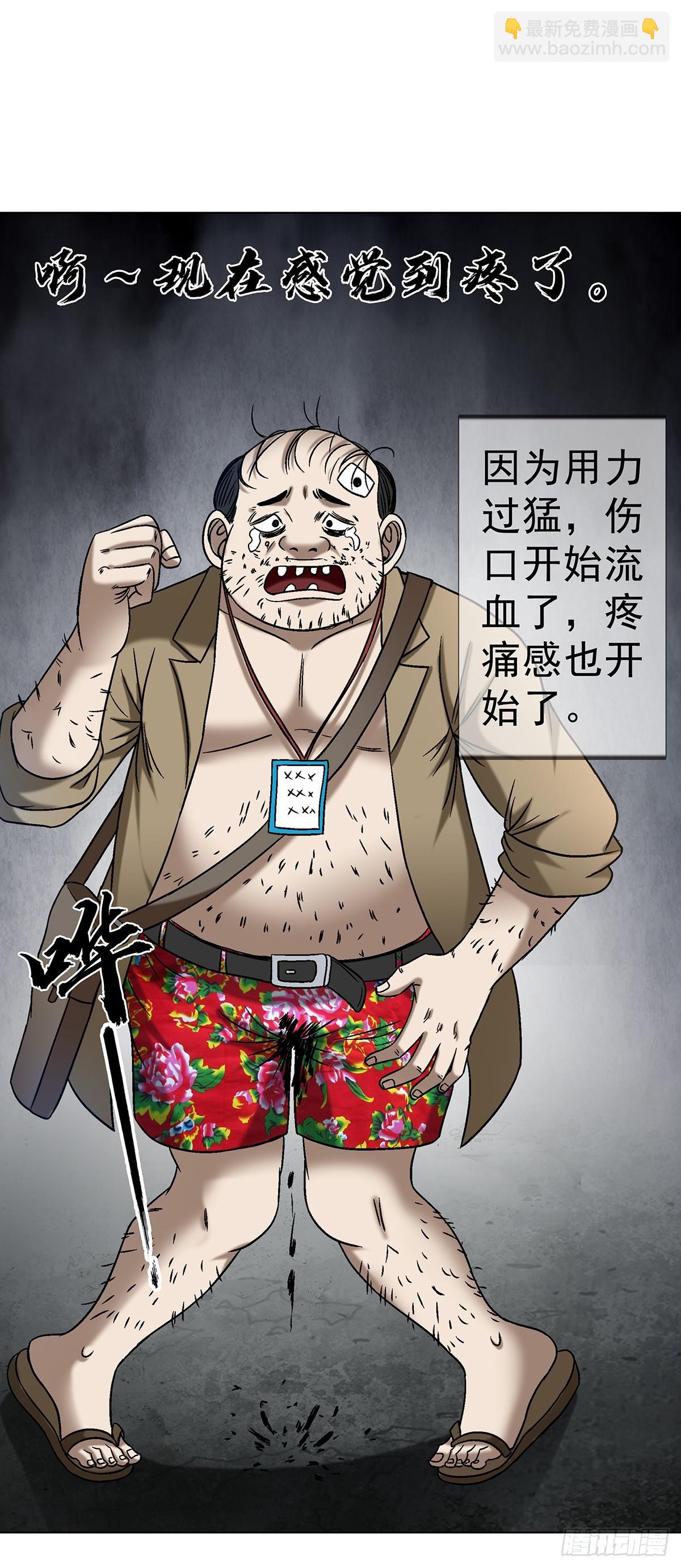 1621 免费小手术13