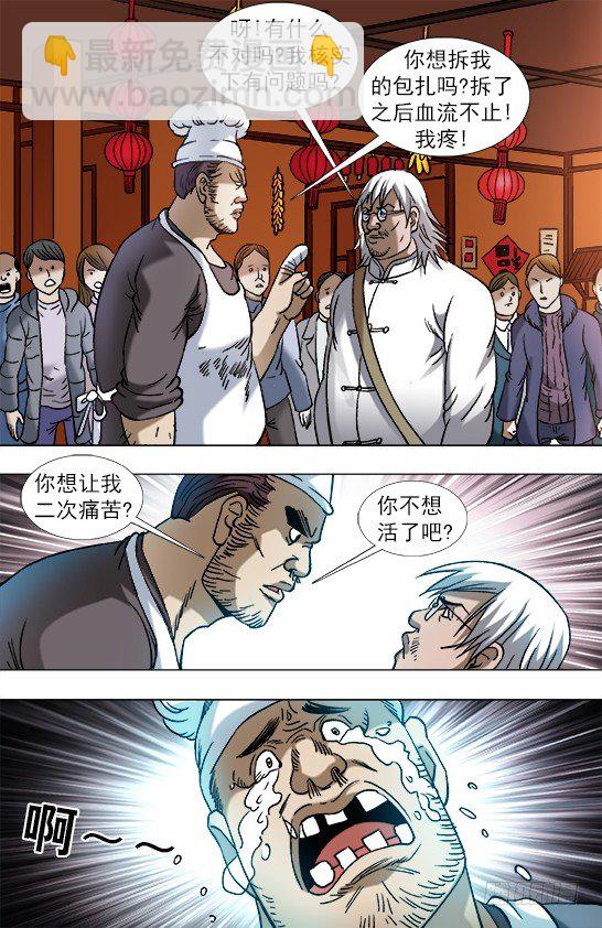 851 断手指7