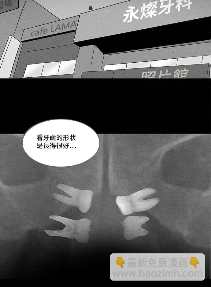 [第130话] Real Implant17