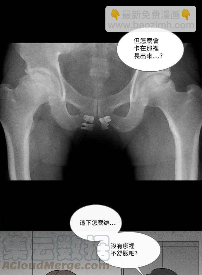 [第130话] Real Implant18