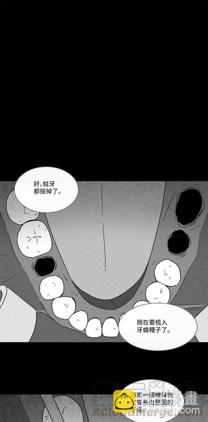 [第130话] Real Implant6