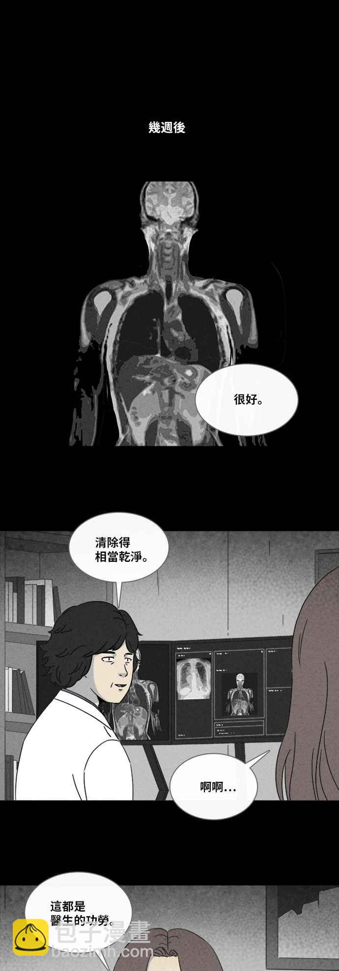 [第319话] 脑 222