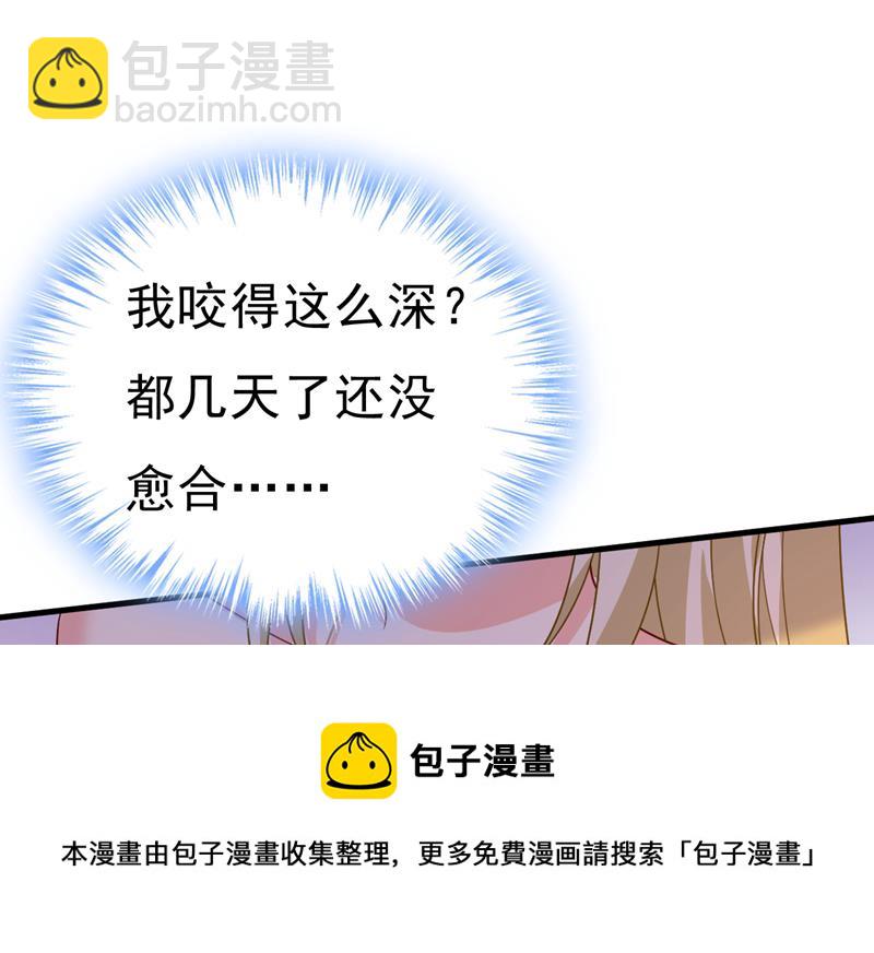 你的手怎么回事？49