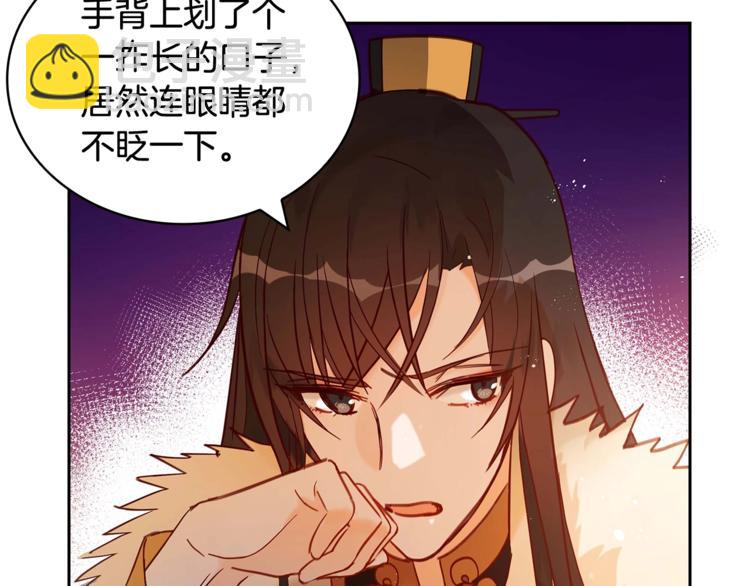 第9话 帝王包扎术与体贴169