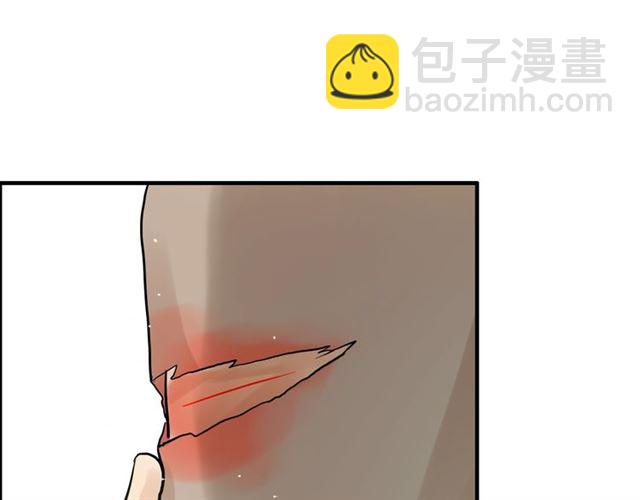 第168话 亲我一下就不疼了60