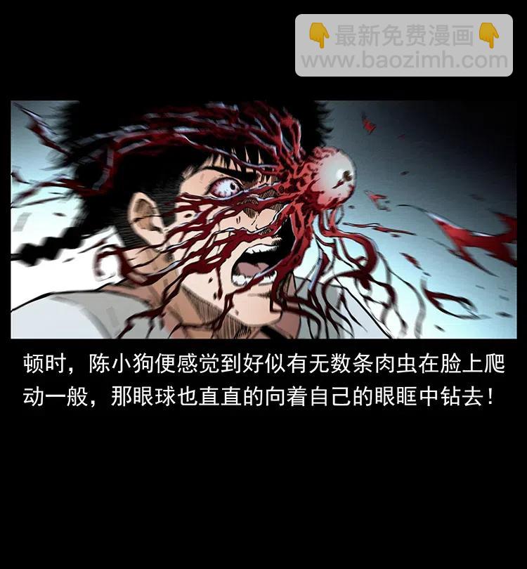 377 尸眼83