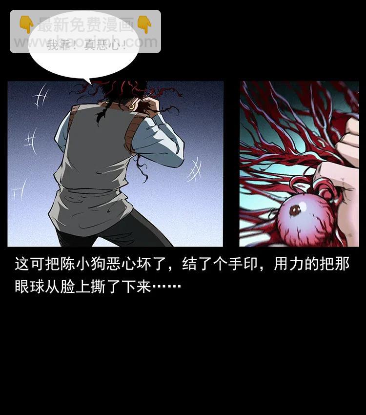 377 尸眼84