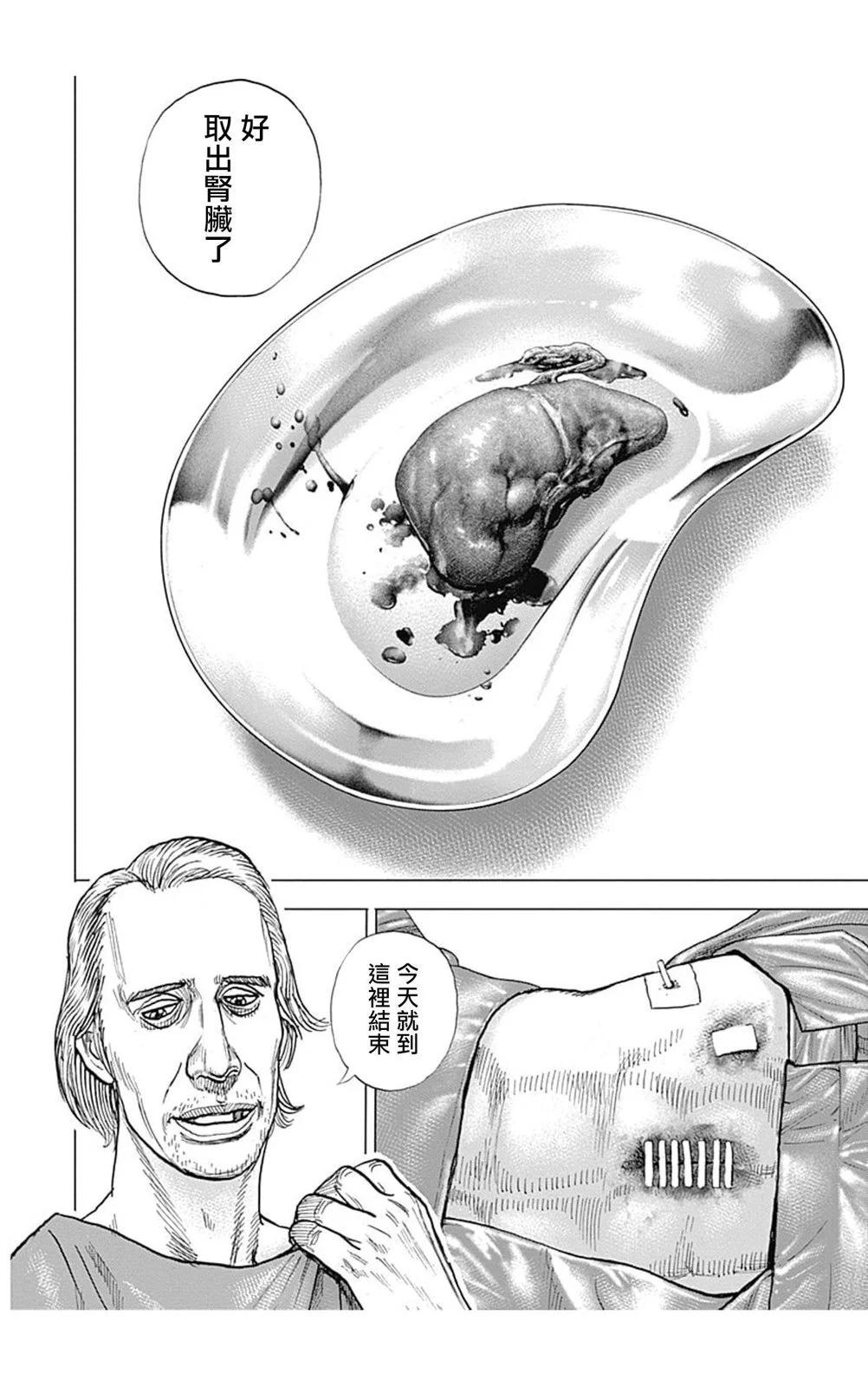 第146话13