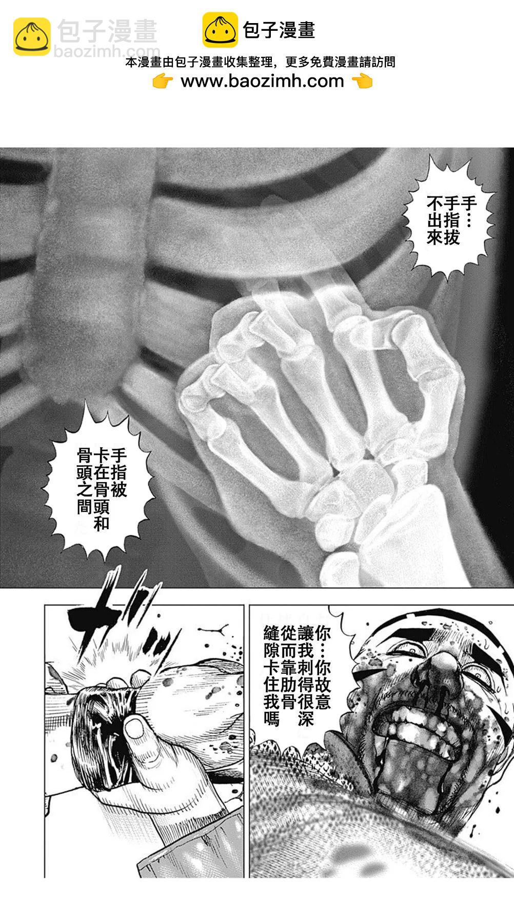 第223话11