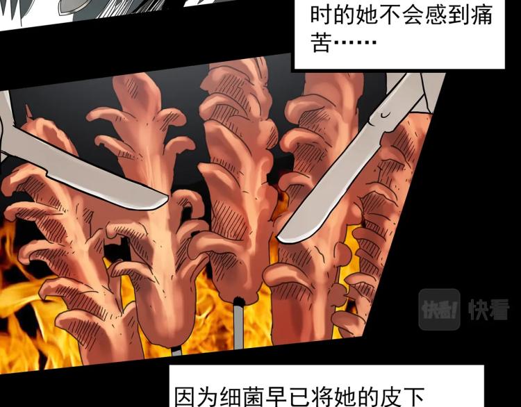 第371话 针管女魔（上）102