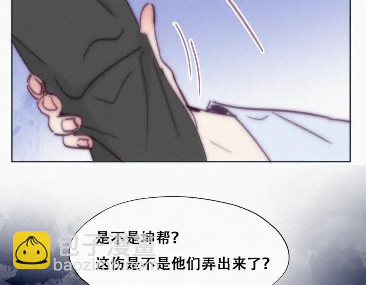 第144话 瞿城受伤98