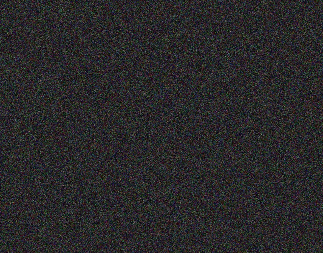 第2季 第17话 移植手术131