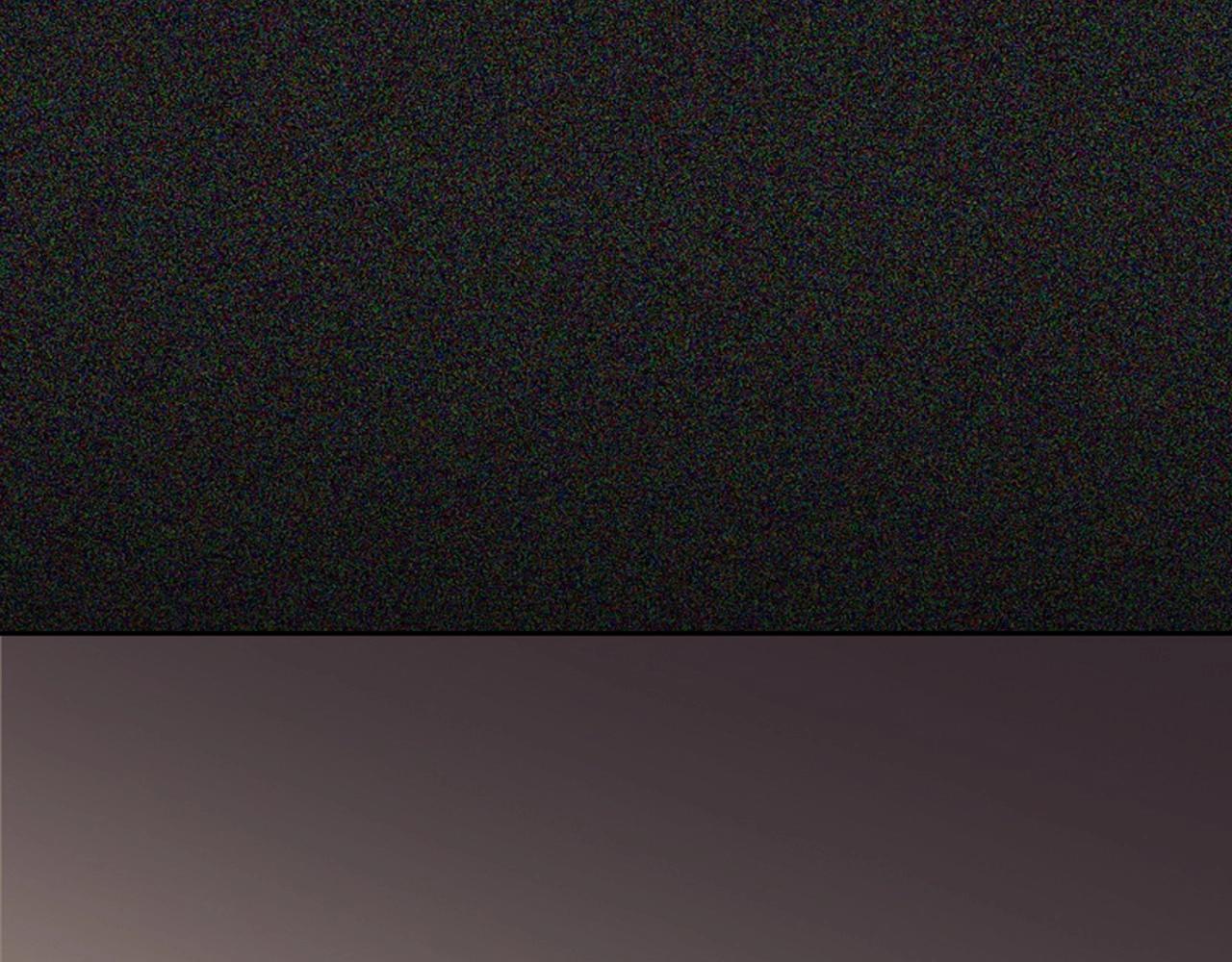 第2季 第17话 移植手术195