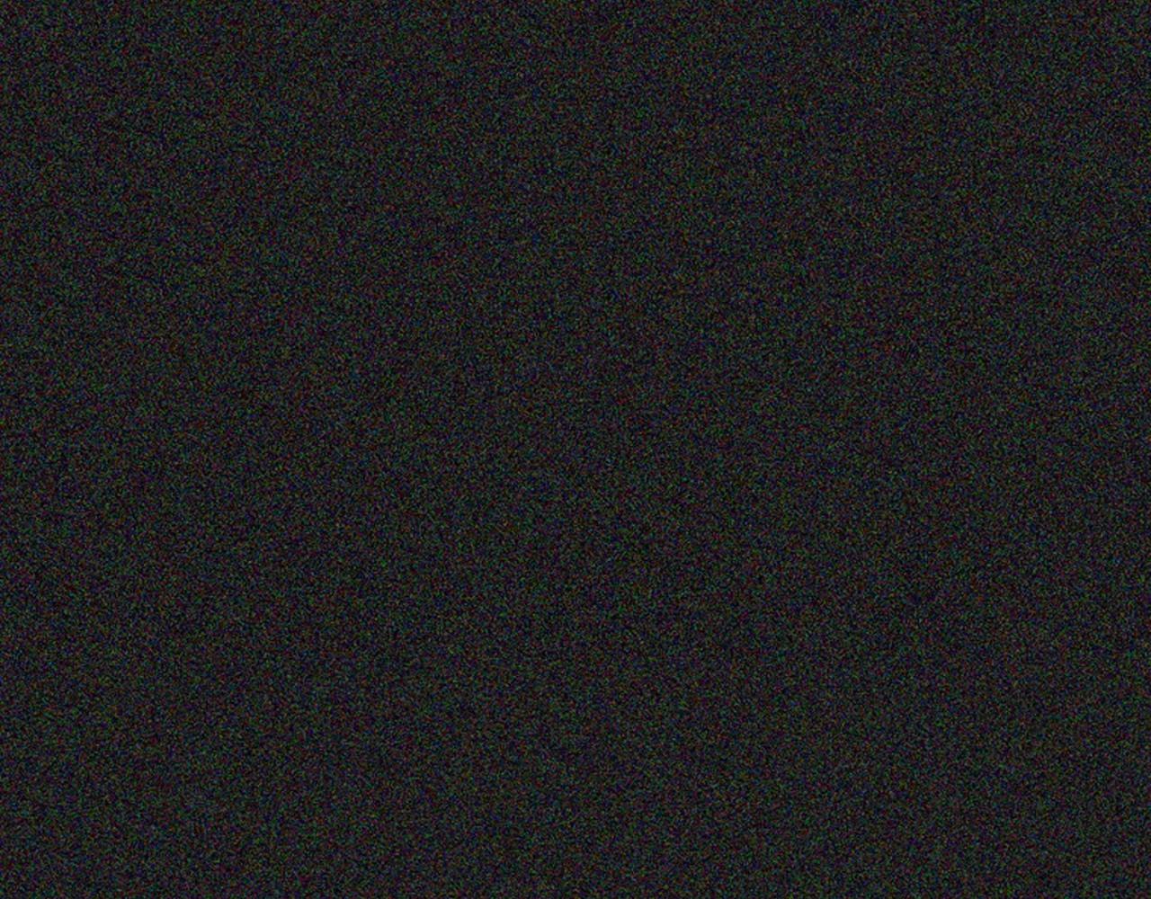第2季 第17话 移植手术26