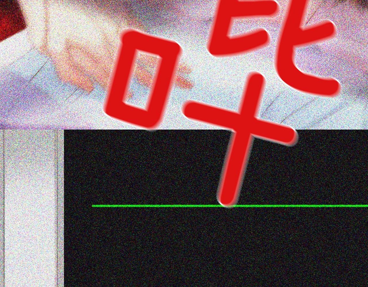 第2季 第17话 移植手术266