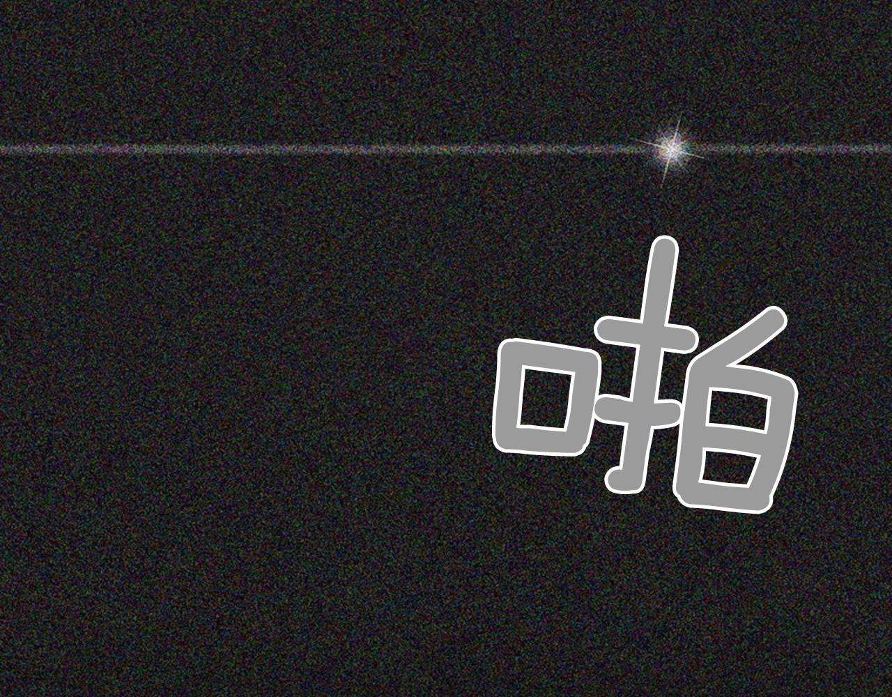 第2季 第17话 移植手术27