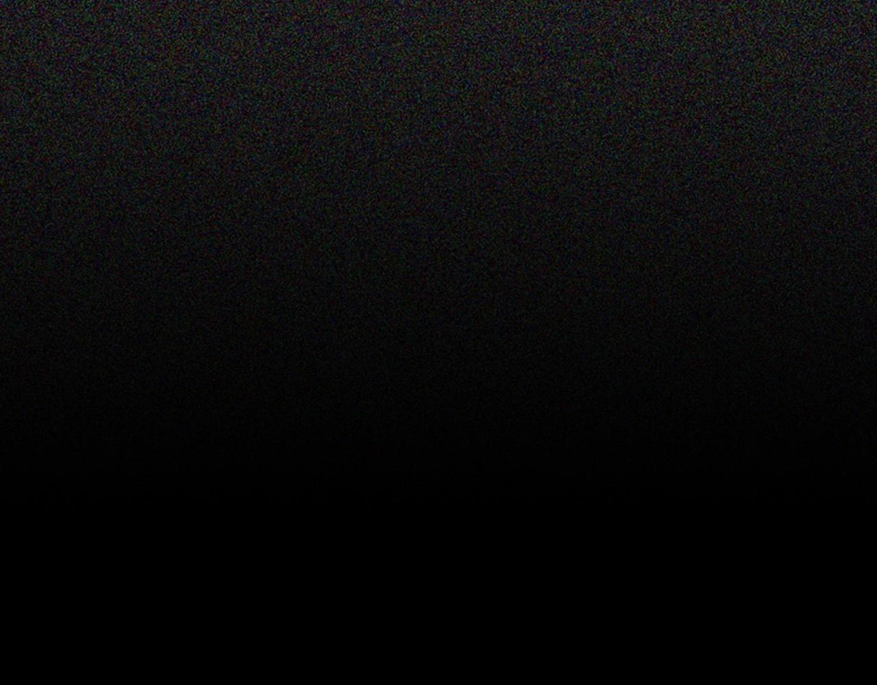 第2季 第17话 移植手术28