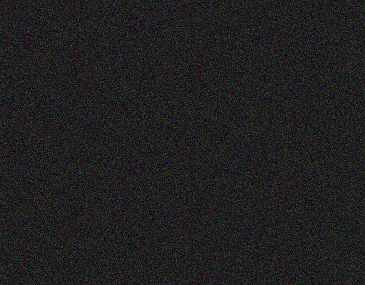 第2季 第17话 移植手术58