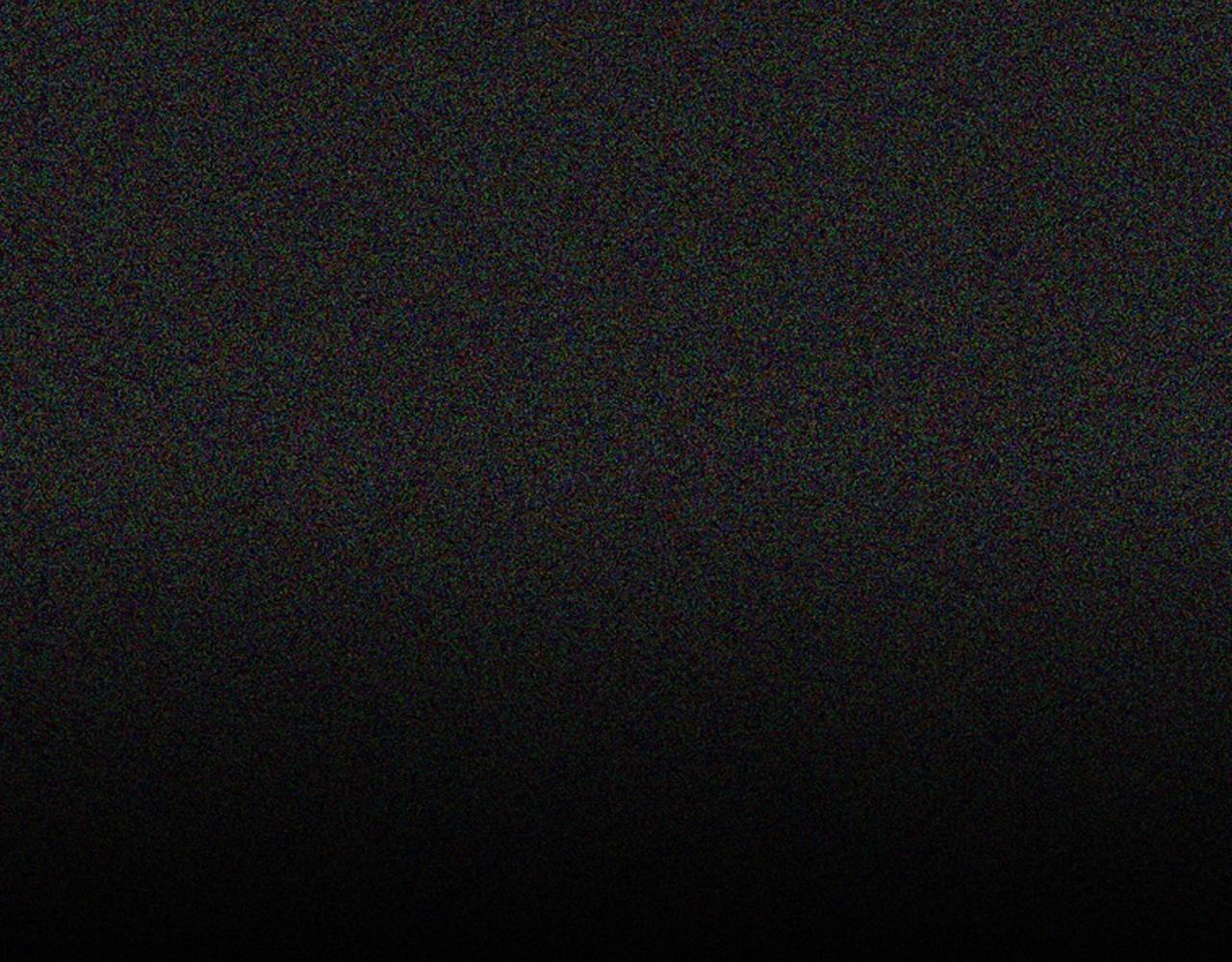 第2季 第17话 移植手术59