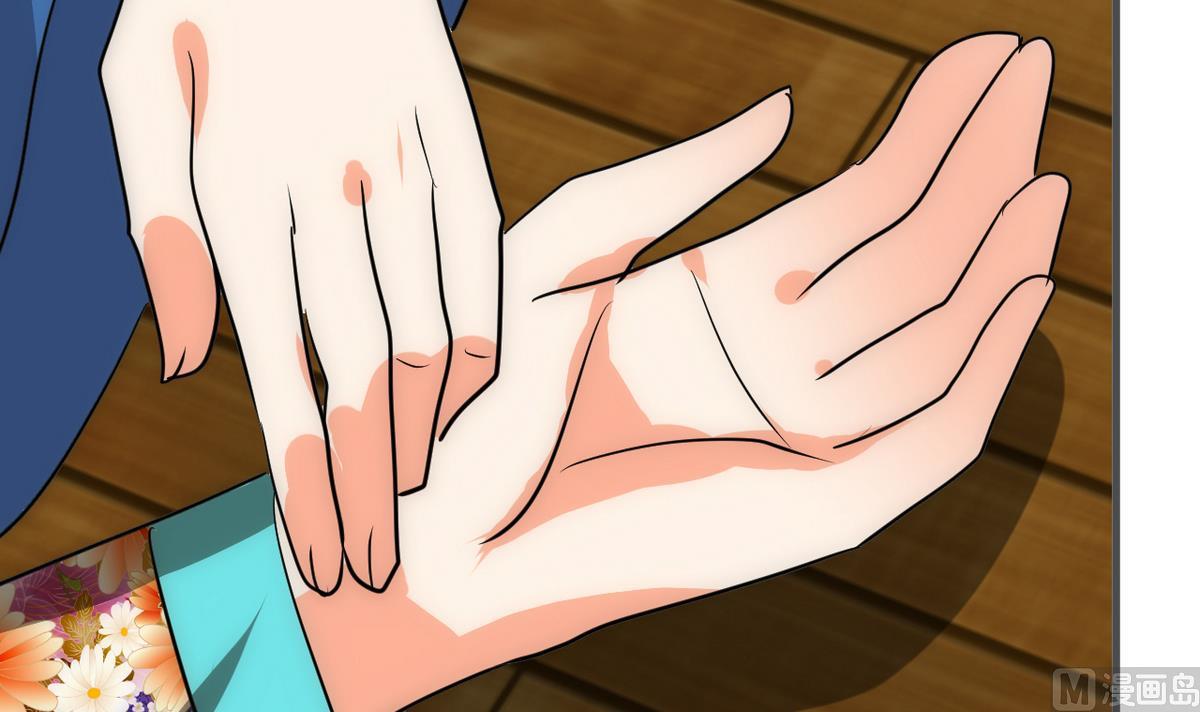 第174话 你是谁？35