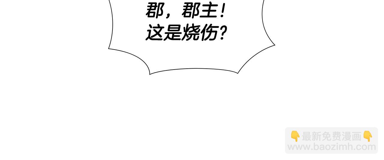 第39话 疤150
