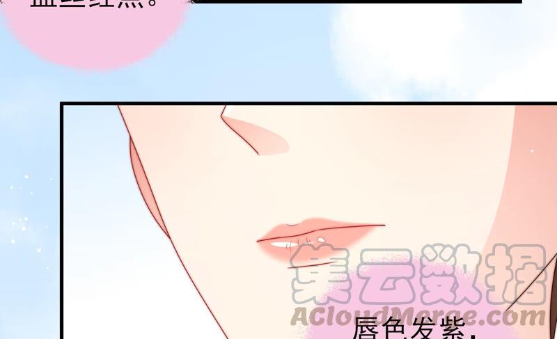 第184话 毒已入骨64