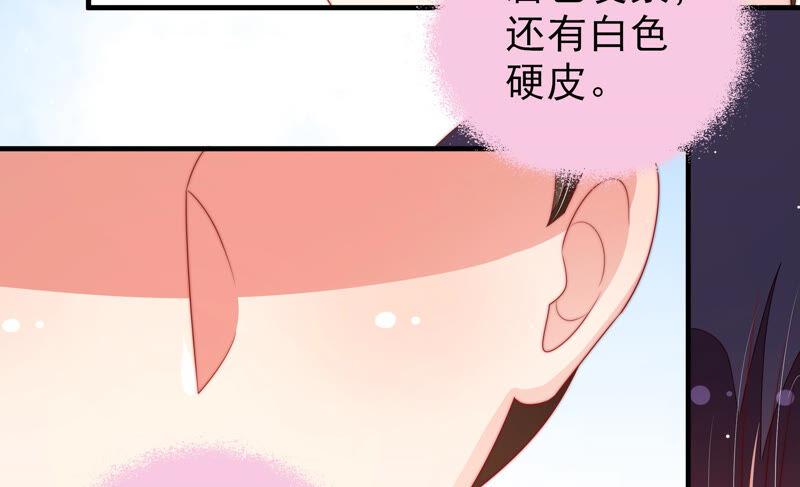 第184话 毒已入骨65