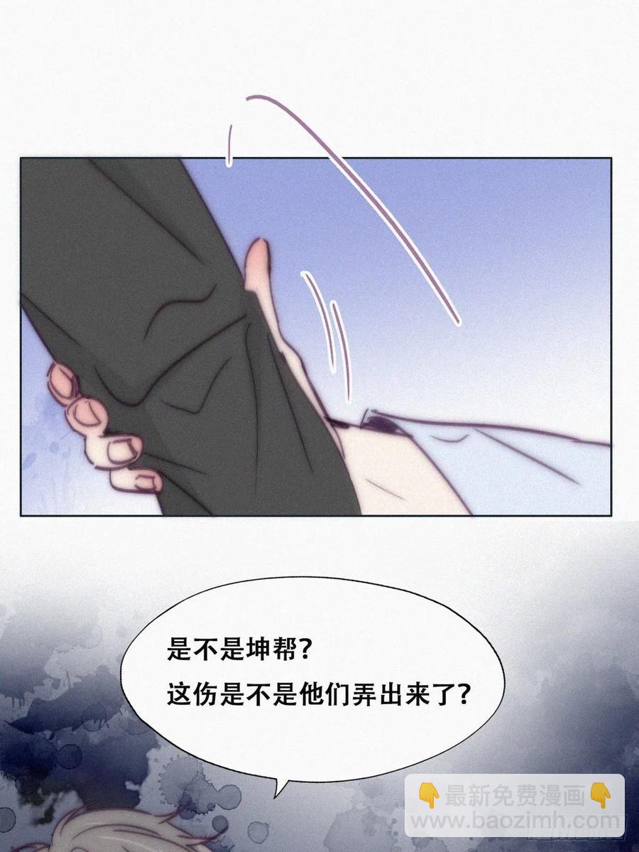 第144话 瞿城受伤44