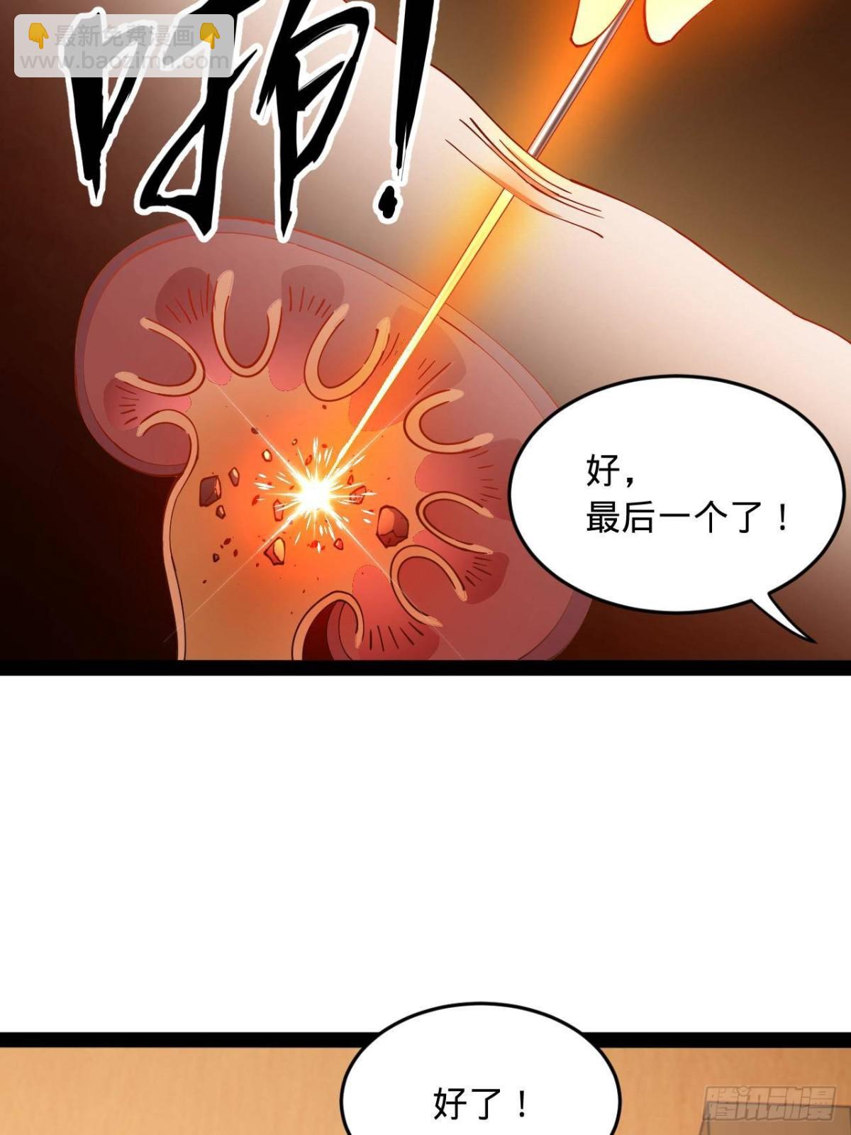 188 碎石成功！金木聪出事！5