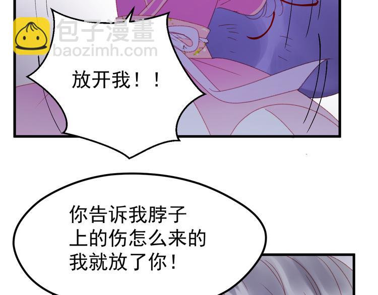 第51话 一样的胎记17