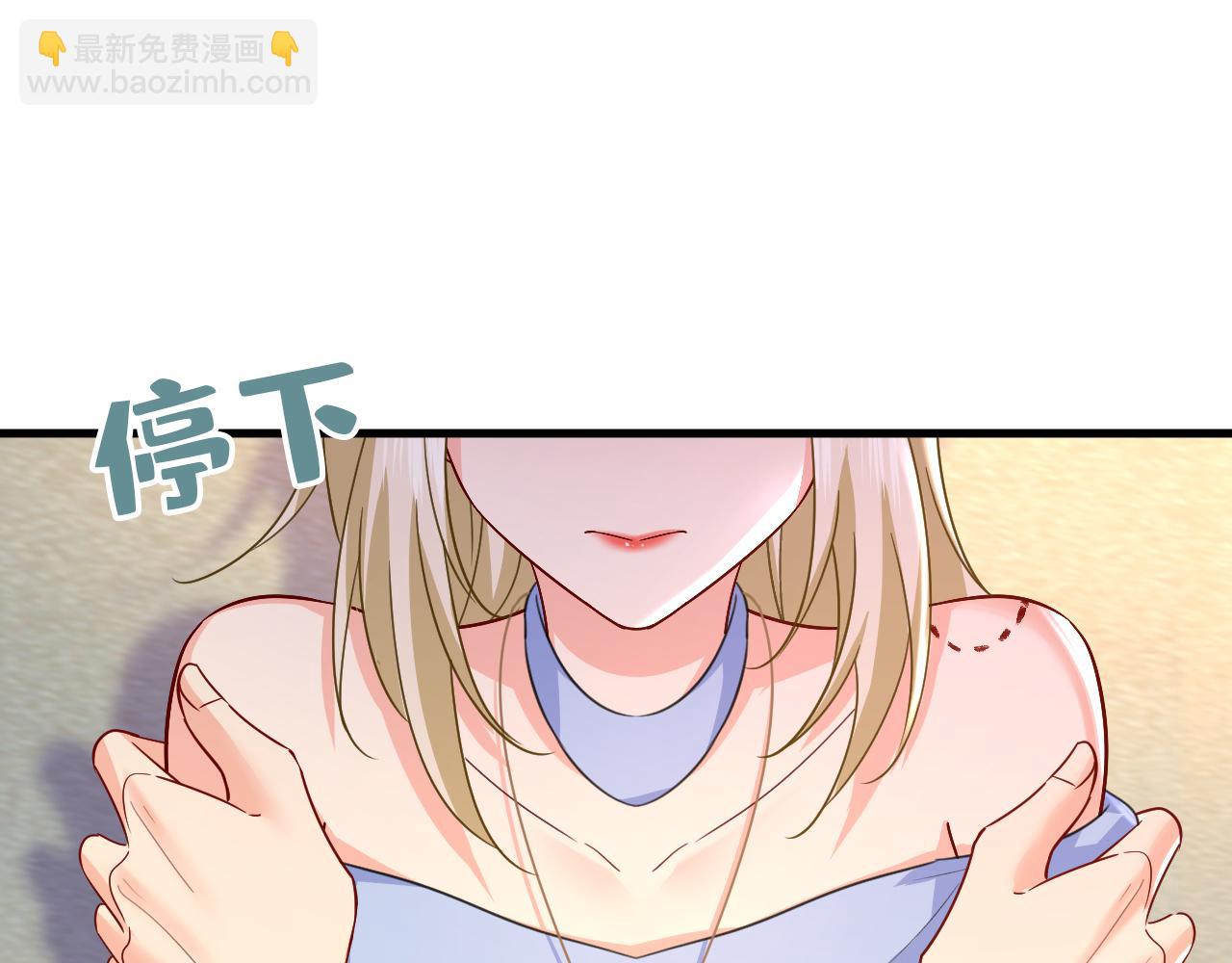 第542话 你的手怎么回事？65