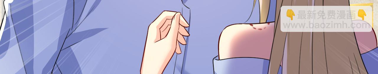 第542话 你的手怎么回事？81